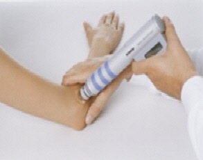 Tennisarm auch Golferarm